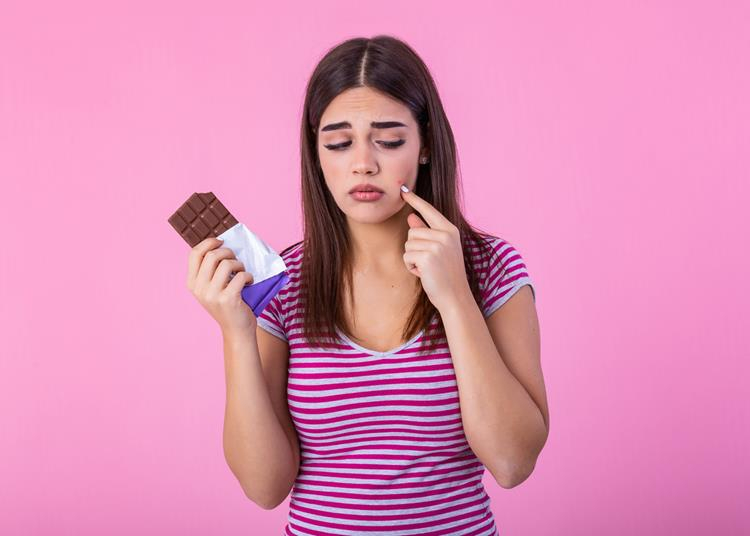 A csokoládé valóban pattanásokat okoz? — Ezeket érdemes enni a szebb bőr érdekében​